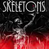 Skeletons - Single album lyrics, reviews, download