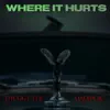 Where it Hurts (feat. Madlogic) - Single album lyrics, reviews, download