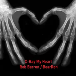 X-ray My Heart Song Lyrics