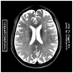 Enzephalopathie (feat. Rugged Ben) Song Lyrics